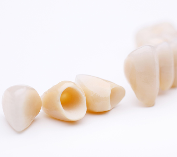 Arlington Dental Crowns and Dental Bridges