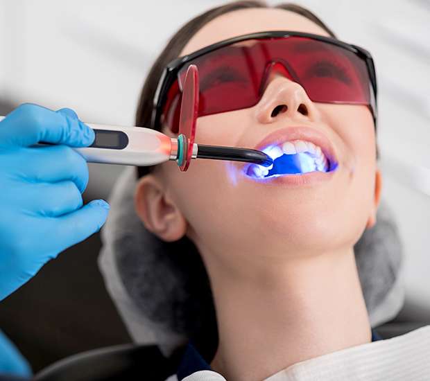 Arlington Professional Teeth Whitening